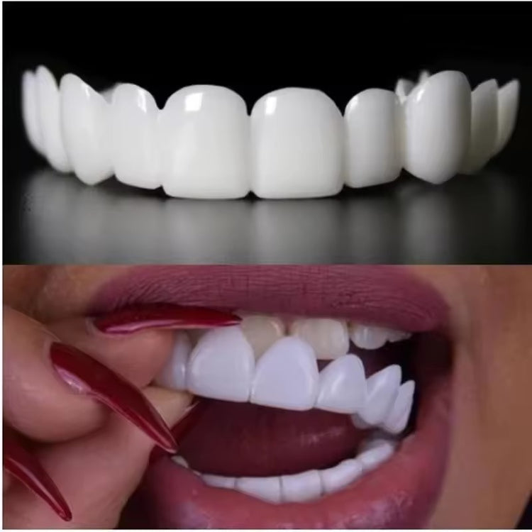 PurePearly™ Snap-On Veneers