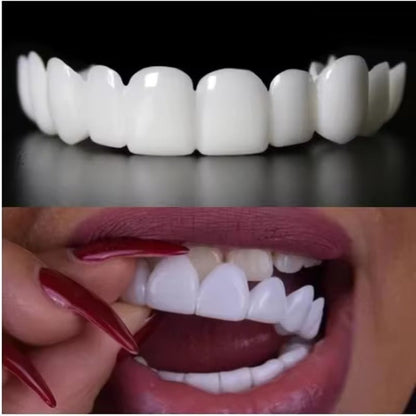 PurePearly™ Snap-On Veneers